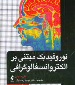 نوروفیدبک مبتنی بر الکتروانسفالوگرافی